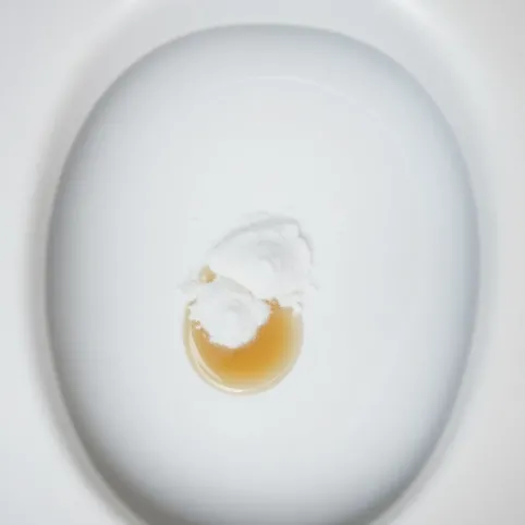 Jak wyczyścić plastikową deskę sedesową